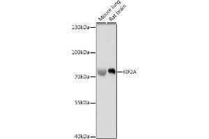 Western blot analysis of extracts of various cell lines, using KIF2A antibody (ABIN7268138) at 1:1000 dilution. (KIF2A antibody  (AA 30-220))
