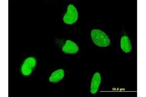 Immunofluorescence of monoclonal antibody to OTX1 on HeLa cell. (OTX1 antibody  (AA 10-116))