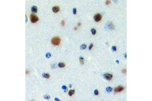 Immunohistochemical analysis of PWWP2B staining in human brain formalin fixed paraffin embedded tissue section. (PWWP2B antibody)