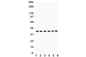 Western blot testing of Rad51 antibody and Lane 1:  22RV1 (RAD51 antibody  (AA 1-258))