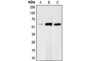 Western blot analysis of CHK1 (pS317) expression in HeLa (A), mouse kidney (B), rat heart (C) whole cell lysates. (CHEK1 antibody  (pSer317))