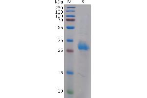Galectin 3 (LGALS3) (AA 2-250) protein (His tag)