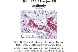 Image no. 2 for anti-Coagulation Factor XII (F12) antibody (ABIN1734212) (F12 antibody)