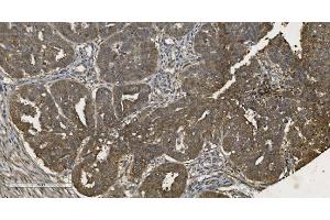 IHC analysis of MPI using anti-MPI antibody (ABIN7600514). (MPI antibody  (AA 2-99))