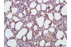 Paraformaldehyde-fixed, paraffin embedded Rat Lung Antigen retrieval by boiling in sodium citrate buffer (pH6. (TGFB1 antibody  (AA 351-390))