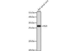 Western blot analysis of extracts of rat spinal cord, using RGR antibody (ABIN6128677, ABIN6146910, ABIN6146911 and ABIN6223922) at 1:1000 dilution. (RGR antibody  (AA 156-295))