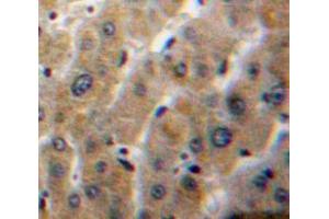 Used in DAB staining on fromalin fixed paraffin-embedded Liver tissue (PLA1A antibody  (AA 148-295))