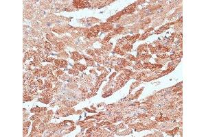 Immunohistochemistry of paraffin-embedded Mouse heart using TMX1 Polyclonal Antibody at dilution of 1:100 (40x lens). (TMX1 antibody)