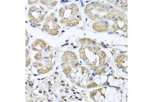 Immunohistochemistry of paraffin-embedded human stomach using IFNL1 antibody at dilution of 1:100 (40x lens). (IL29 antibody)