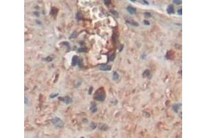 IHC-P analysis of Rat Tissue, with DAB staining. (COMP antibody  (AA 235-423))