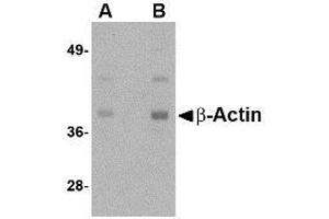Image no. 1 for anti-Actin, beta (ACTB) (N-Term) antibody (ABIN341736)