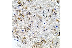 Immunohistochemistry of paraffin-embedded mouse brain using CAST antibody (ABIN3015047, ABIN3015048, ABIN5663576 and ABIN6213614) at dilution of 1:100 (40x lens). (Calpastatin antibody  (C-Term))