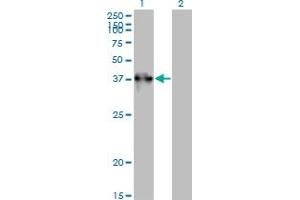 Western Blot analysis of TEX264 expression in transfected 293T cell line by TEX264 monoclonal antibody (M01), clone 2A3-1A10. (TEX264 antibody  (AA 1-313))