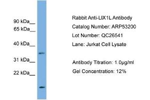 WB Suggested Anti-LIX1L  Antibody Titration: 0. (LIX1L antibody  (N-Term))