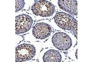 IHC analysis of SSRP1 using anti-SSRP1 antibody (ABIN7600496). (SSRP1 antibody  (AA 2-381))
