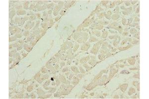 Immunohistochemistry of paraffin-embedded human heart tissue using ABIN7169525 at dilution of 1:100 (SHOX2 antibody  (AA 72-331))