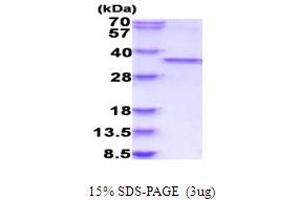 SDS-PAGE (SDS) image for Cyclin-Dependent Kinase 1 (CDK1) (AA 1-297) protein (His tag) (ABIN5853963)