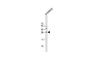 Anti-SOST Antibody (N-term) at 1:500 dilution + human kidney lysate Lysates/proteins at 20 μg per lane. (Sclerostin antibody  (N-Term))