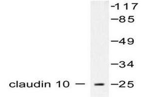 Image no. 1 for anti-Claudin 10 (CLDN10) antibody (ABIN265359) (CLDN10 antibody)
