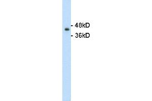 WB Suggested Anti-GNAS Antibody Titration:  1ug/mL  Positive Control:  HepG2 lysate There is BioGPS gene expression data showing that GNAS is expressed in HepG2
