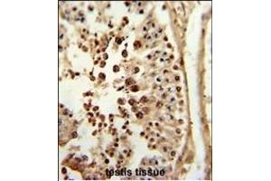 Formalin-fixed and paraffin-embedded human testis tissue reacted with P3R2 Antibody (N-term), which was peroxidase-conjugated to the secondary antibody, followed by DAB staining. (Calcineurin B antibody  (N-Term))