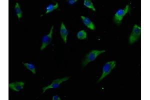Immunofluorescence staining of U251 cells with ABIN7156793 at 1:50, counter-stained with DAPI. (IL13 Receptor alpha 1 antibody  (AA 22-234))
