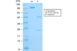SDS-PAGE Analysis Purified Cytokeratin 16 Mouse Recombinant Monoclonal Antibody (KRT16/1714). (Recombinant KRT16 antibody  (C-Term))