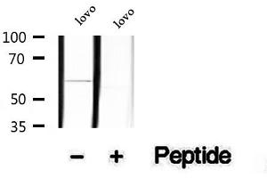 Western blot analysis of extracts of lovo cells, using Phospho-KLF4(Ser254) Antibody.