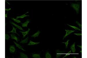 Immunofluorescence of monoclonal antibody to DST on HeLa cell. (Dystonin antibody  (AA 401-500))