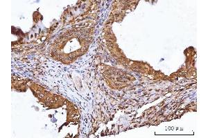 IHC analysis of TIP49A/RUVBL1 using anti-TIP49A/RUVBL1 antibody (ABIN7599928).