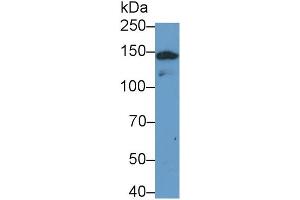 Detection of PLIN4 in Hela cell lysate using Polyclonal Antibody to Perilipin 4 (PLIN4)