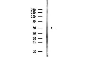 anti-Tripartite Motif Containing 15 (TRIM15) (C-Term) antibody