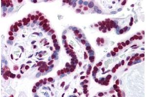 Immunohistochemistry (Formalin-fixed Paraffin-embedded Sections) (IHC (fp)) image for anti-High Mobility Group Box 1 (HMGB1) (AA 1-216) antibody (ABIN574266)
