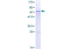 QPCT Protein (AA 1-361) (GST tag)