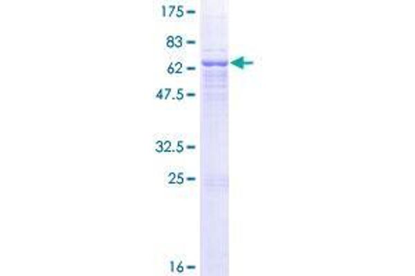 QPCT Protein (AA 1-361) (GST tag)