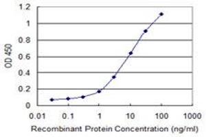 Detection limit for recombinant GST tagged RAB7B is 0. (RAB7B antibody  (AA 100-199))