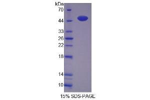 SDS-PAGE (SDS) image for Renalase, FAD-Dependent Amine Oxidase (RNLS) (AA 18-180) protein (His tag,GST tag) (ABIN3209932)