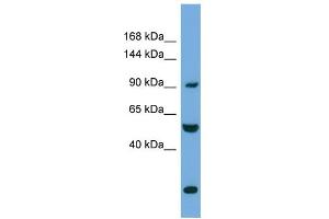 WB Suggested Anti-EXOC1 Antibody Titration: 0.