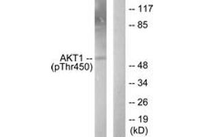 Western blot analysis of extracts from NIH-3T3 cells treated with PDGF 50ng/ml 20', using Akt1 (Phospho-Thr450) Antibody. (AKT1 antibody  (pThr450))