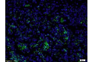 Formalin-fixed and paraffin embedded rat brain labeled with Anti-Smoothened/SMO Polyclonal Antibody, Unconjugated (ABIN680908) at 1:200, followed by conjugation to the secondary antibody and DAB staining (SMO antibody  (AA 551-650))