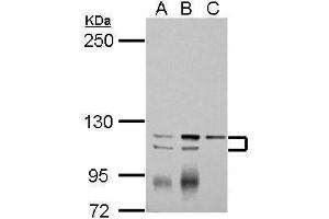 WB Image Sample (30 ug of whole cell lysate) A: Jurkat B: Raji C: K562 5% SDS PAGE antibody diluted at 1:2000 (ATP2A3 antibody  (N-Term))