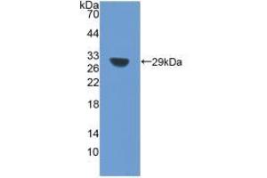 Western blot analysis of the recombinant protein. (SIRT1 antibody  (AA 238-482))