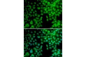 Immunofluorescence analysis of A549 cell using VDR antibody. (Vitamin D Receptor antibody  (AA 1-300))