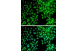 Immunofluorescence analysis of A549 cell using VDR antibody. (Vitamin D Receptor antibody  (AA 1-300))