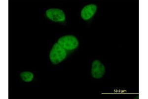 Immunofluorescence of purified MaxPab antibody to ARS2 on HeLa cell. (SRRT antibody  (AA 1-796))