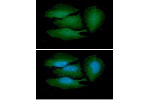 anti-BRCA1/BRCA2-Containing Complex, Subunit 3 (BRCC3) (AA 1-316) antibody