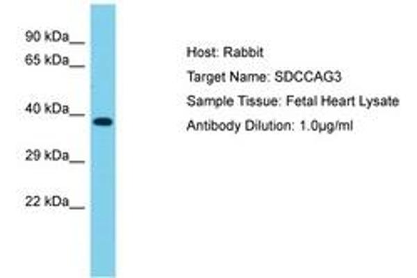 SDCCAG3 antibody  (AA 221-270)