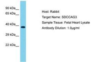 Image no. 1 for anti-serologically Defined Colon Cancer Antigen 3 (SDCCAG3) (AA 221-270) antibody (ABIN6750584)