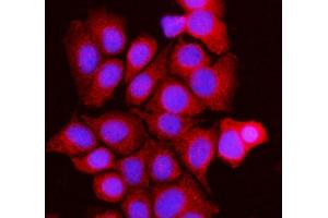 IF analysis of BCKDK using anti-BCKDK antibody (ABIN7601470).