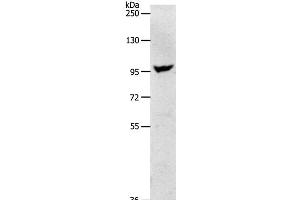 Western Blot analysis of Human fetal brain tissue using NFATC2 Polyclonal Antibody at dilution of 1:650 (NFAT1 antibody)